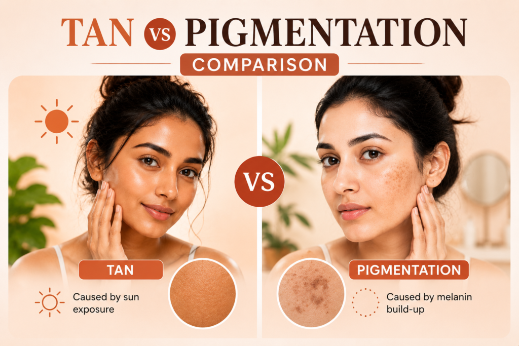 difference between tan and pigmentation on Indian skin